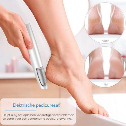 Effortless Electric Callus Remover – Achieve Soft Feet with Ease