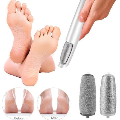 Effortless Electric Callus Remover – Achieve Soft Feet with Ease