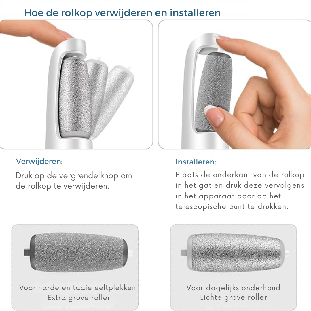 Effortless Electric Callus Remover – Achieve Soft Feet with Ease