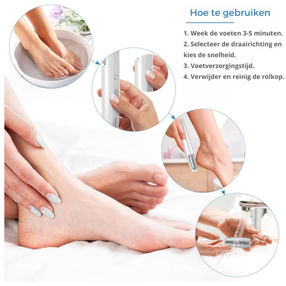 Effortless Electric Callus Remover – Achieve Soft Feet with Ease