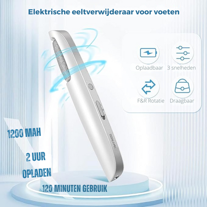 Effortless Electric Callus Remover – Achieve Soft Feet with Ease